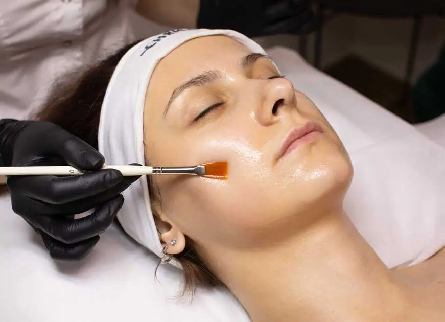 Chemical Peels in Richmond, KY by Empower Aesthetics