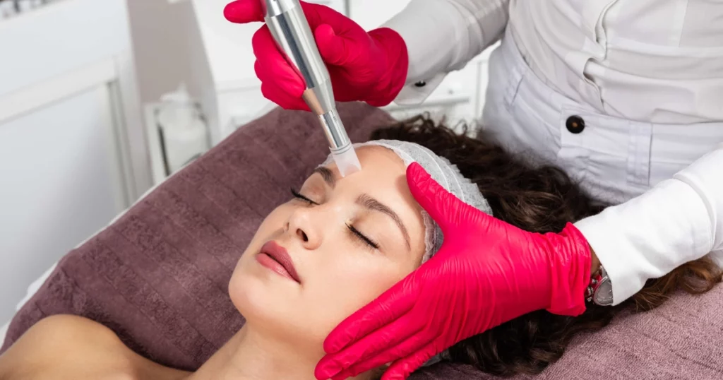 A woman receiving a microneedling facial treatment in Richmond, KY from a skincare professional wearing pink gloves, focusing on skin rejuvenation in a clinical setting.